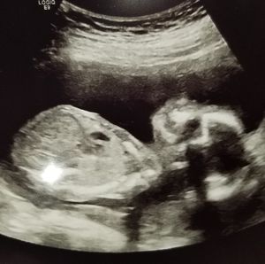 Meet your Posher, Jeffery